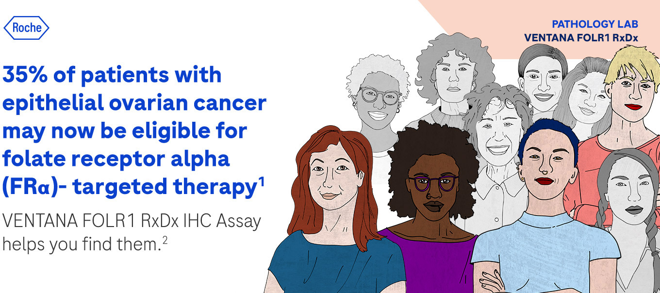 35% of patients with epithelial ovarian cancer may now be eligible for folate receptor alpha (FRa)- targeted therapy(1) VENTANA FOLR1 RxDx IHC Assay helps you find them.(2)